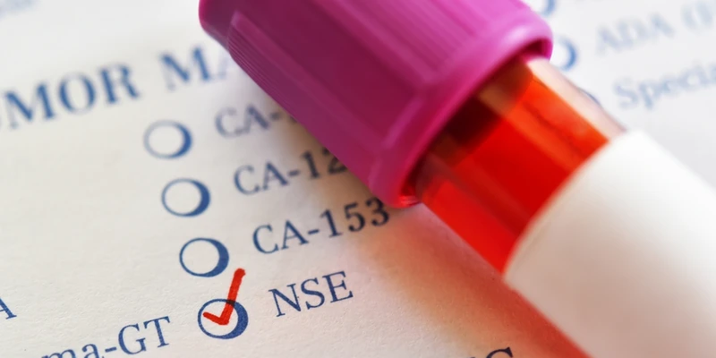 NSE (Neuron Specific Enolase) là một enzyme đặc hiệu của tế bào thần kinh và tế bào nội tiết thần kinh