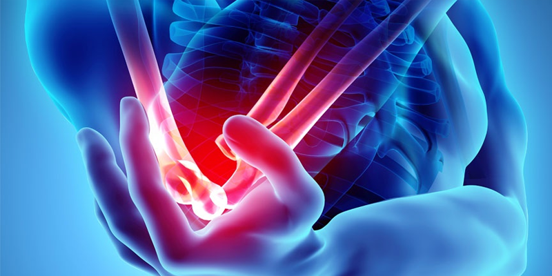 Osteosarcoma là ung thư xương nguyên phát ác tính