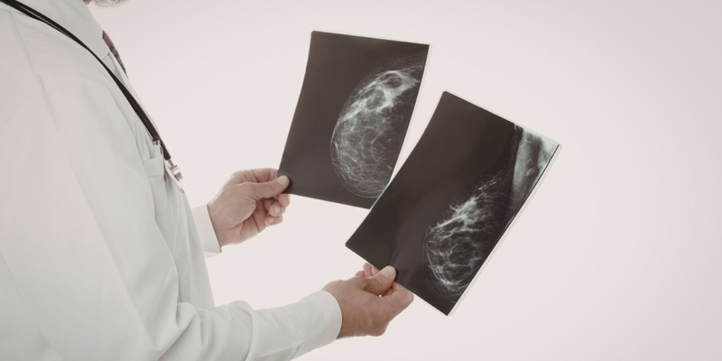 Điều trị nhắm trúng đích áp dụng khi HER2 dương tính để tăng hiệu quả điều trị