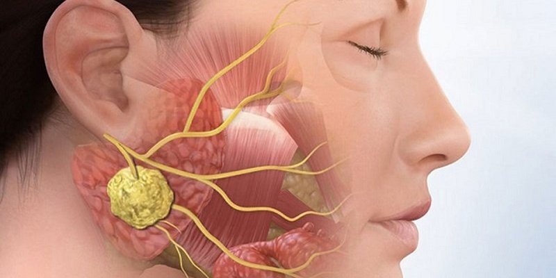 Phát hiện hình ảnh ung thư xương quai hàm thông qua khám lâm sàng