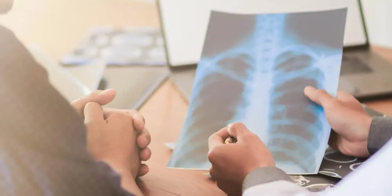 Phương pháp điều trị ung thư phổi di căn gan