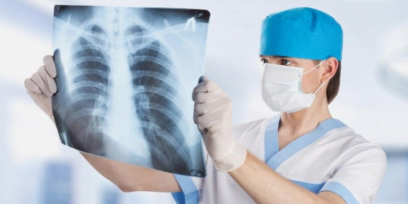 Điều trị ung thư phổi thứ phát sớm nhất có thể để ngăn ngừa bệnh