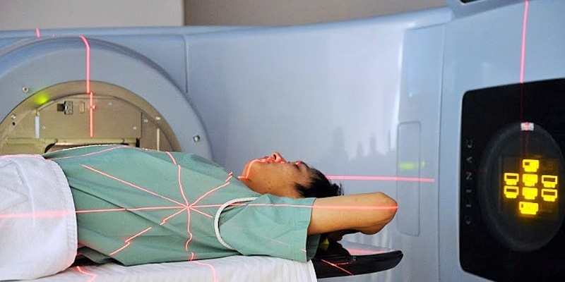 Xạ trị được thực hiện sau phẫu thuật để tiêu diệt các tế bào ung thư