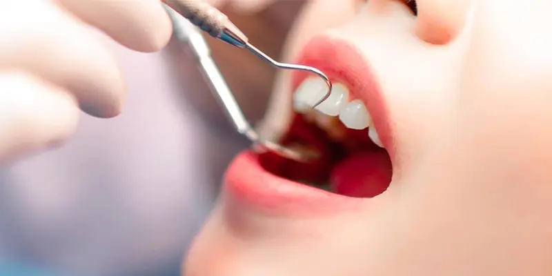 Khám sức khỏe răng miệng định kỳ giúp bạn phòng ngừa ung thư khoang miệng tốt nhất