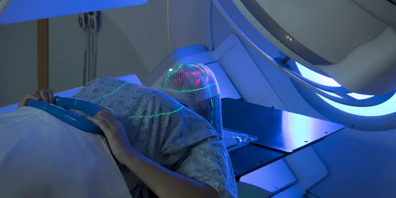 Phẫu thuật và xạ trị trong điều trị ung thư khoang miệng