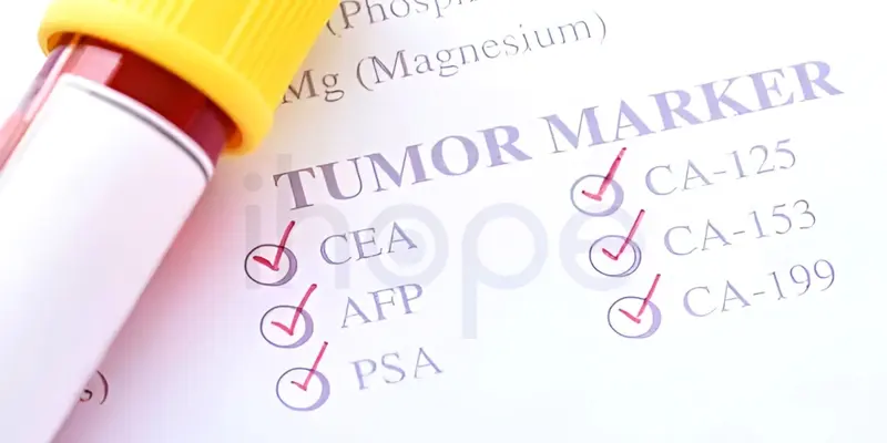 Các xét nghiệm máu có thể gợi ý chẩn đoán và theo dõi