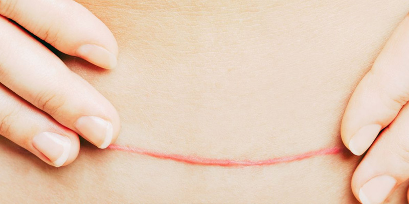 Người bệnh cần điều trị ung thư vú theo chỉ định của bác sĩ chuyên khoa