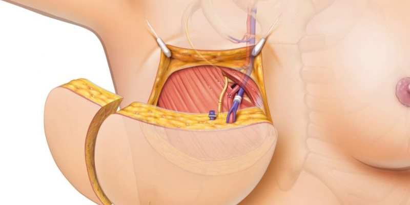 Người bệnh được thăm khám, đánh giá, tư vấn kỹ trước phẫu thuật