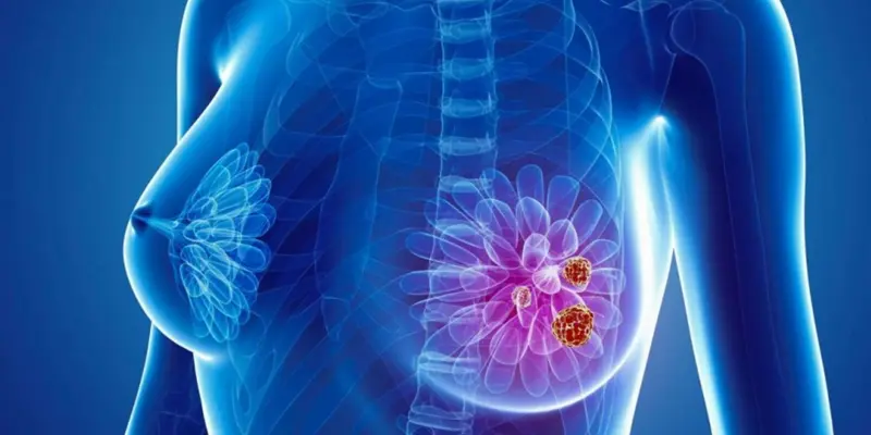 Tại sao chế độ ăn uống lại quan trọng đối với người ung thư vú