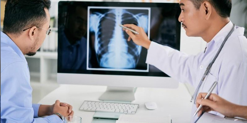 Chụp X-quang phổi để quan sát cấu trúc phổi và phát hiện bất thường