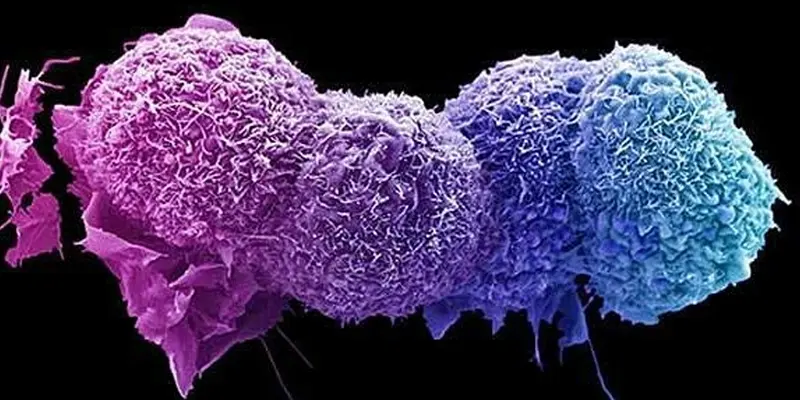 Thử nghiệm lâm sàng ngăn sự phát triển của các tế bào ung thư di căn