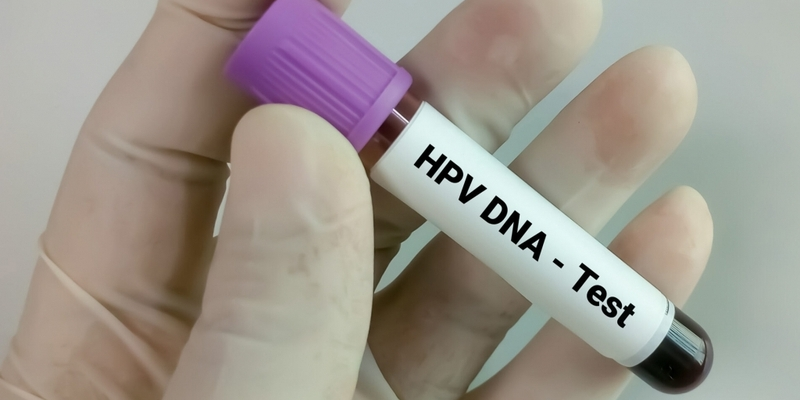 Xét nghiệm HPV giúp phát hiện sớm tiền ung thư cổ tử cung