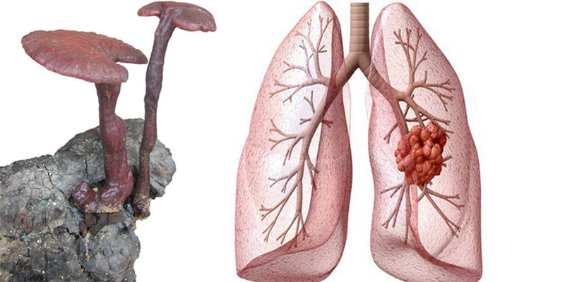 Nấm lim xanh chữa ung thư phổi