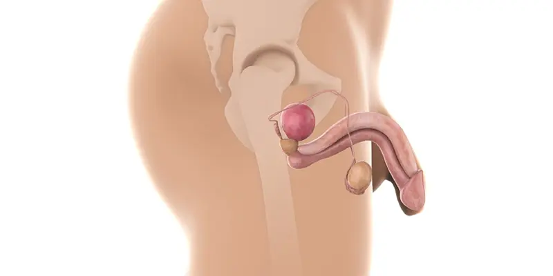 Các dạng ung thư dương vật