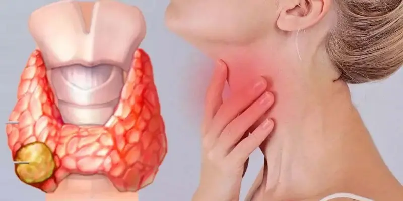 Ung thư tuyến giáp có tiên lượng rất tốt nếu được phát hiện sớm và điều trị kịp thời
