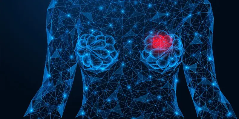 Ung thư vú dạng nhú là dạng hiếm gặp, có kích thước nhỏ.