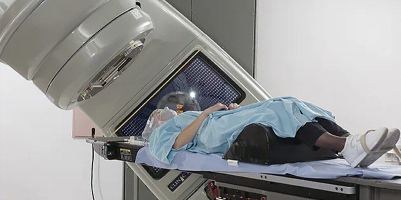 Xạ trị là một trong các phương pháp điều trị ung thư bàng quang giai đoạn cuối