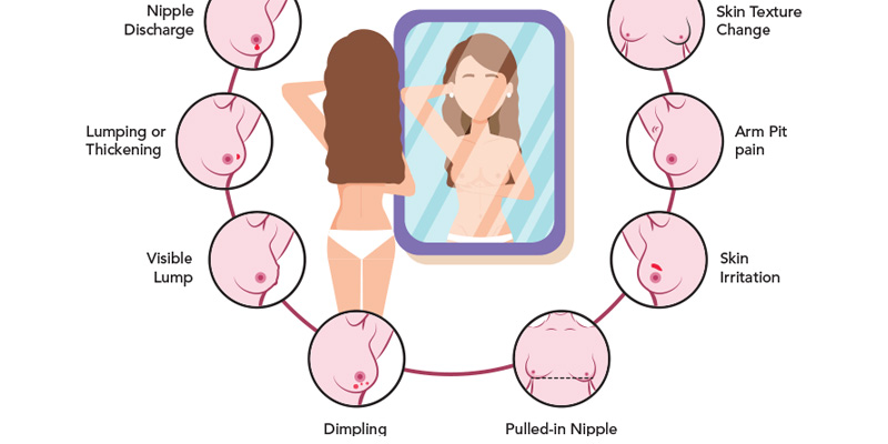 Các triệu chứng bất thường ở vú gợi ý bệnh lý ung thư vú