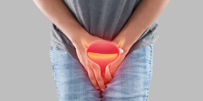 Tiến triển của bệnh u bàng quang lành tính khá chậm