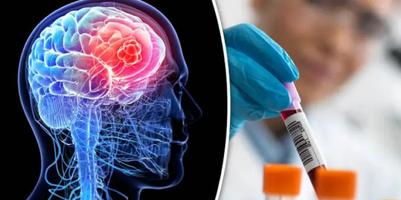 U tế bào mầm nội sọ chiếm 4% ở trẻ em