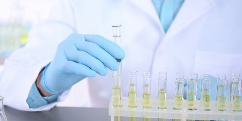 Xét nghiệm nước tiểu cũng góp phần giúp chẩn đoán bệnh u thận
