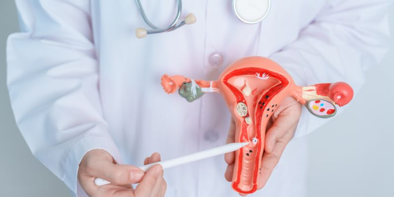 Ung thư biểu mô cổ tử cung là căn bệnh nguy hiểm cho phụ nữ