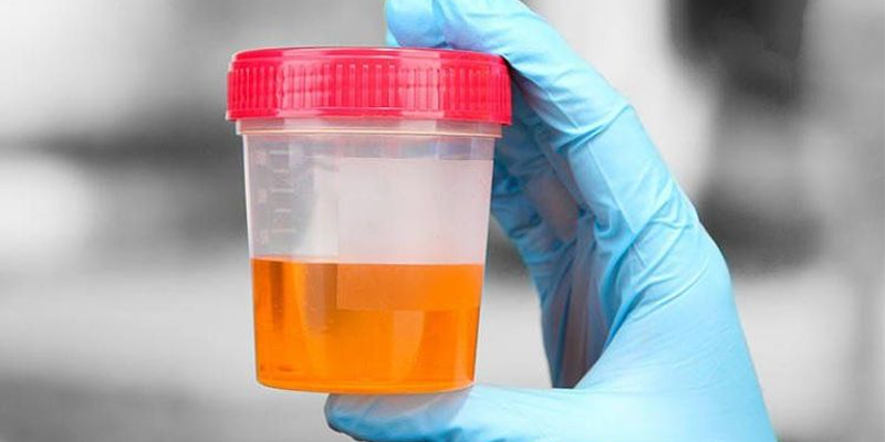 Tiểu máu là một trong các triệu chứng thường gặp của ung thư biểu mô tế bào thận di căn