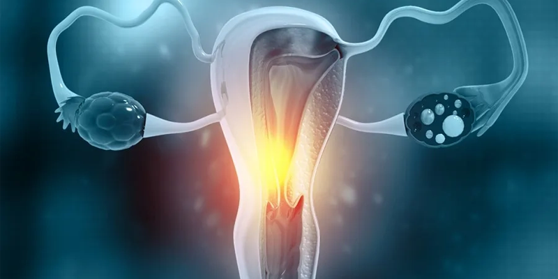 Ung thư cổ tử cung di căn có thể lan đến phổi, gan, xương khiến quá trình điều trị phức tạp hơn và ảnh hưởng đến tiên lượng sống