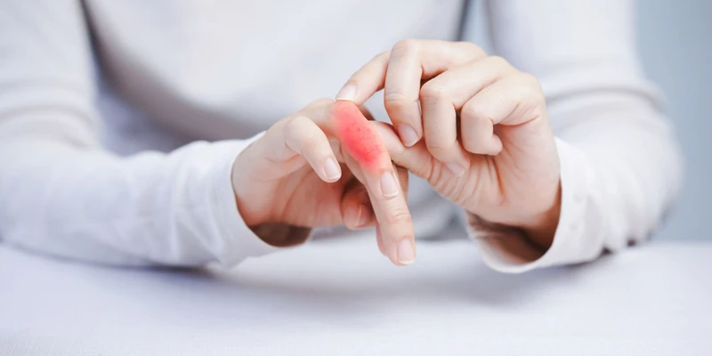 Vùng xương bị di căn có thể xuất hiện tình trạng bị sưng nhẹ