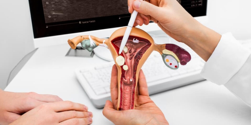 Ung thư cổ tử cung là tình trạng bệnh lý do virus HPV gây ra
