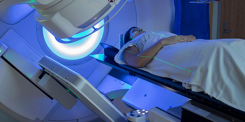 Xạ trị là phương pháp điều trị ung thư cổ tử cung giai đoạn 2