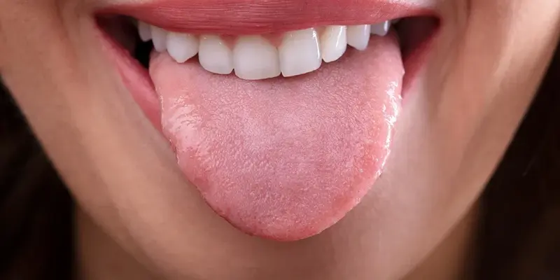 Ung thư lưỡi giai đoạn 2 là giai đoạn trung bình