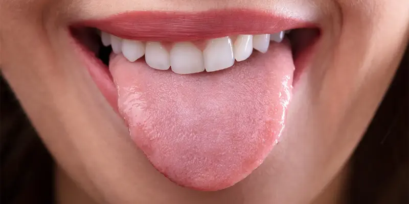 Ung thư lưỡi giai đoạn cuối sống được bao lâu phụ thuộc vào từng giai đoạn bệnh