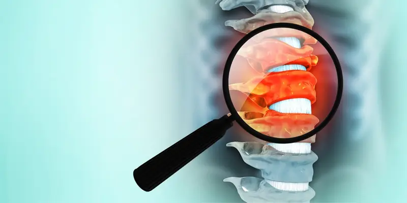 Ung thư tủy sống nguy hiểm không, câu trả lời là có