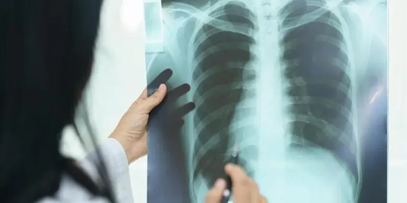 Ung thư tuyến giáp có thể lan nhanh sang các cơ quan khác khi bước vào giai đoạn cuối của bệnh