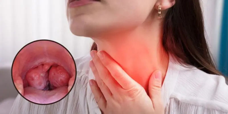 Ung thư vòm họng có tỷ lệ mắc cao hơn ở các quốc gia Đông Nam Á