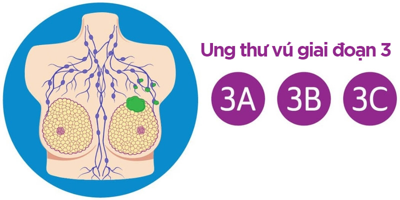 Trog đó giai đoạn 3 có ba mức độ phát triển