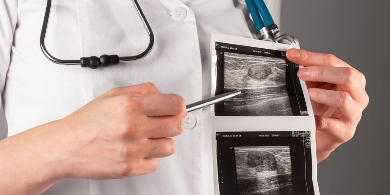 Siêu âm vú quy trình đơn giản và cho kết quả nhanh chóng