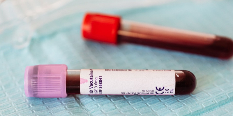 Gia đình nguy cơ cao có thể được chỉ định xét nghiệm máu để sàng lọc đột biến gen liên quan ung thư vú