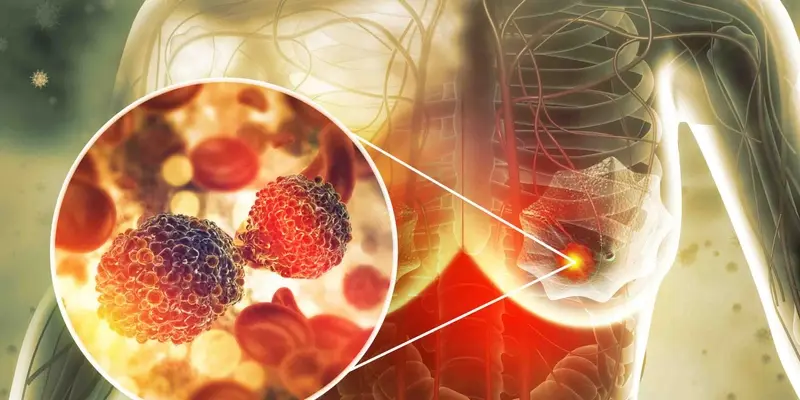 Sàng lọc ung thư vú giúp phát hiện sớm bất kỳ biểu hiện hay dấu hiệu của bệnh