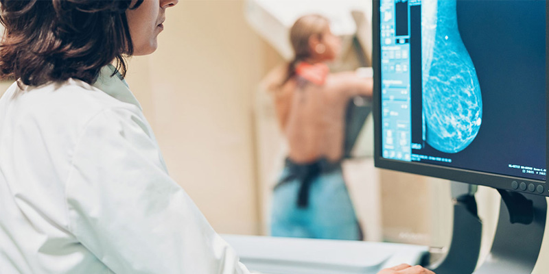 Tầm soát ung thư vú định kỳ được xem là giải pháp quan trọng giúp bảo vệ sức khỏe