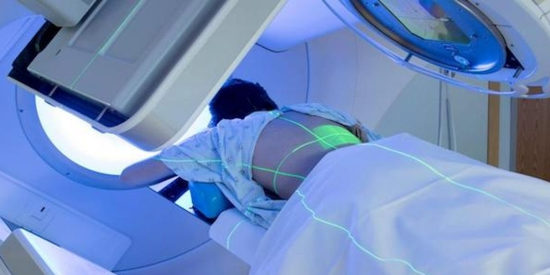 Xạ trị điều trị bệnh u lympho không Hodgkin ở giai đoạn muộn