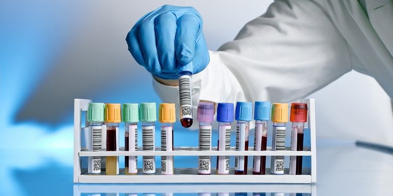 Xét nghiệm máu có phát hiện ung thư không? Có thể, nhưng thường chỉ đóng vai trò gợi ý cho các xét nghiệm chuyên sâu hơn.