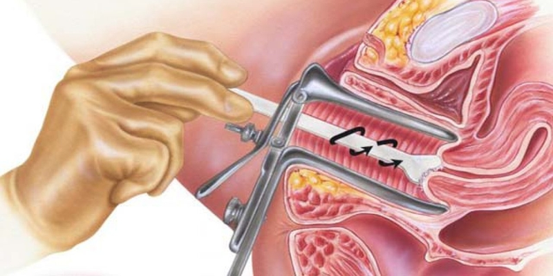 Nên thực hiện tầm soát bằng xét nghiệm tế bào cổ tử cung