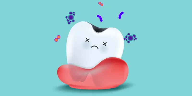 Các bệnh lý về răng miệng như viêm nướu, viêm quanh răng làm tăng nguy cơ mắc u nang dưới lưỡi