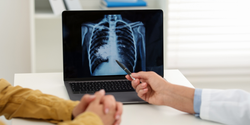 Nếu khối u còn nhỏ, chưa di căn, bệnh nhân có thể được chỉ định phẫu thuật