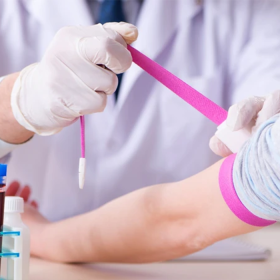 Bệnh bạch cầu lympho mãn tính: Nguyên nhân, cách điều trị và chăm sóc
