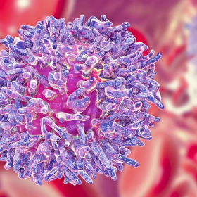 Bệnh Leukemia là gì? Nguyên nhân, triệu chứng và điều trị bệnh
