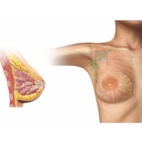 Cách nhận biết biểu hiện ung thư vú trước khi quá muộn