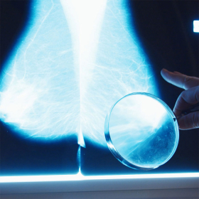 Bướu sợi tuyến vú: Triệu chứng, mức độ nguy hiểm và phòng ngừa